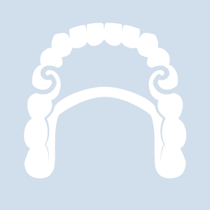 Stegprothese Abbildung einer Prothese mit Stegverankerung